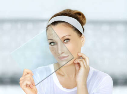 Dark spots, freckles,hyperpigmentation(melasma or chloasma),concept - skin lightening, skin whitening, fruit acids,AHA, Skin Brightening.